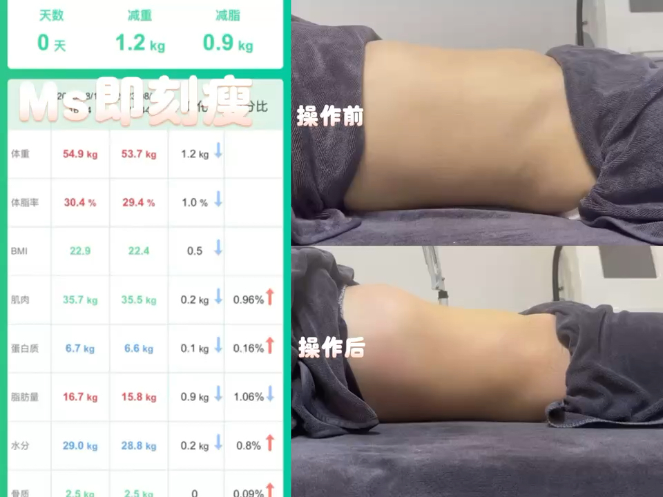 最新瘦情况重塑自信，焕发自我光彩